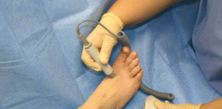 All'ospedale di Paola in arrivo il biotesiometro per la prevenzione del 'piede diabetico'